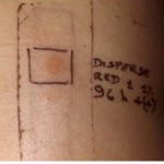 Patch test per determinare l’eventuale reazione allergica